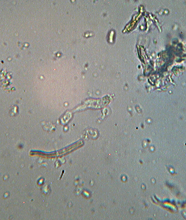 Thanatephorus sterigmaticus. Trovato da Paolofon